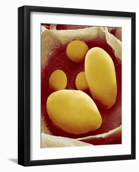 Starch Grains of Potato Cells-Micro Discovery-Framed Photographic Print