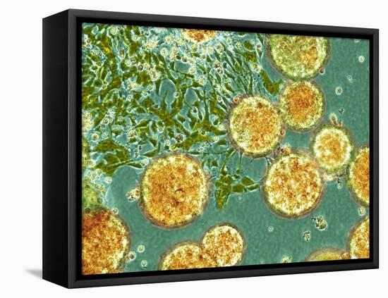 Stem Cells, Light Micrograph-NIBSC-Framed Stretched Canvas