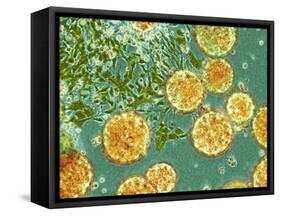 Stem Cells, Light Micrograph-NIBSC-Framed Stretched Canvas