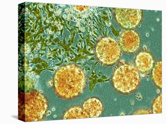 Stem Cells, Light Micrograph-NIBSC-Stretched Canvas