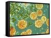 Stem Cells, Light Micrograph-NIBSC-Framed Stretched Canvas