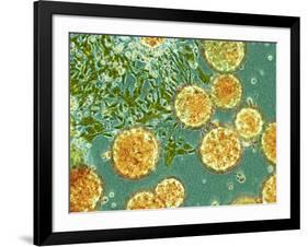 Stem Cells, Light Micrograph-NIBSC-Framed Photographic Print