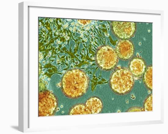 Stem Cells, Light Micrograph-NIBSC-Framed Photographic Print