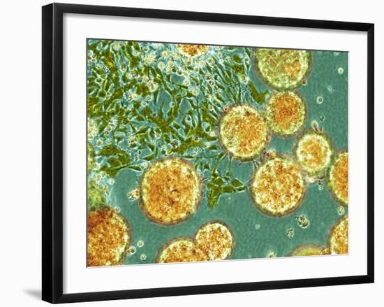 Stem Cells, Light Micrograph-NIBSC-Framed Photographic Print