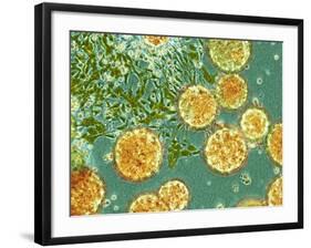 Stem Cells, Light Micrograph-NIBSC-Framed Photographic Print