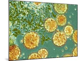 Stem Cells, Light Micrograph-NIBSC-Mounted Photographic Print