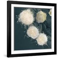 Stem Cells, SEM-Science Photo Library-Framed Photographic Print