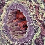 Coloured SEM of Podocytes In the Human Kidney-Steve Gschmeissner-Photographic Print