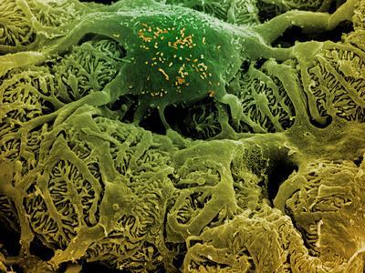 Coloured SEM of Podocytes In the Human Kidney