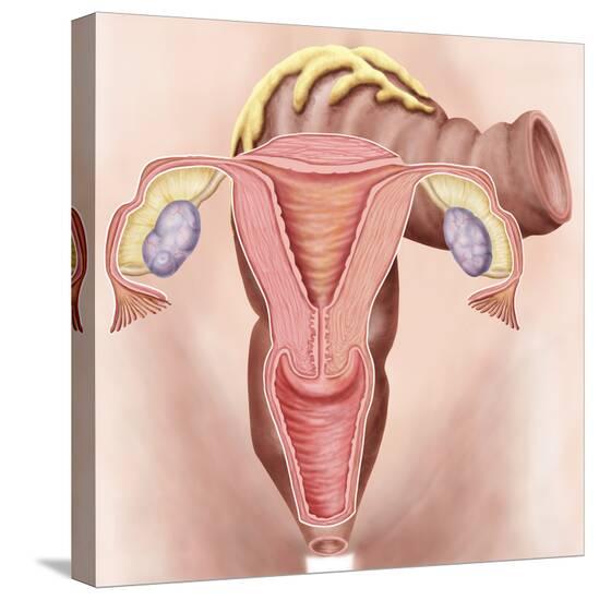 Stretched Canvas Print, , large