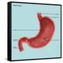 Stomach Ulcers, Illustration-Gwen Shockey-Framed Stretched Canvas