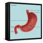 Stomach Ulcers, Illustration-Gwen Shockey-Framed Stretched Canvas