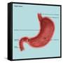 Stomach Ulcers, Illustration-Gwen Shockey-Framed Stretched Canvas