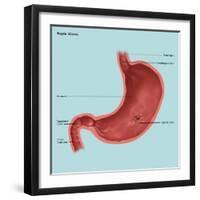 Stomach Ulcers, Illustration-Gwen Shockey-Framed Giclee Print