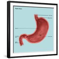 Stomach Ulcers, Illustration-Gwen Shockey-Framed Premium Giclee Print