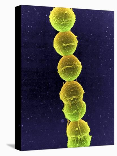 Streptococcus Bacteria, SEM-Tina Carvalho-Stretched Canvas