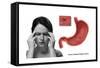 Stress Ulcer, Conceptual Illustration-Gwen Shockey-Framed Stretched Canvas