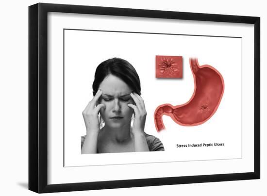 Stress Ulcer, Conceptual Illustration-Gwen Shockey-Framed Art Print