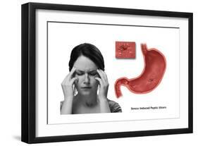 Stress Ulcer, Conceptual Illustration-Gwen Shockey-Framed Art Print