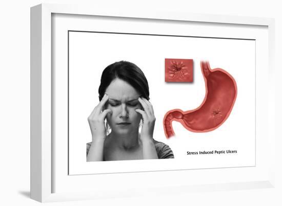 Stress Ulcer, Conceptual Illustration-Gwen Shockey-Framed Art Print