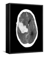 Subarachnoid Haemorrhage, MRI Scan-Du Cane Medical-Framed Stretched Canvas