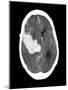 Subarachnoid Haemorrhage, MRI Scan-Du Cane Medical-Mounted Photographic Print