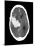 Subarachnoid Haemorrhage, MRI Scan-Du Cane Medical-Mounted Photographic Print