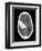 Subarachnoid Haemorrhage, MRI Scan-Du Cane Medical-Framed Photographic Print