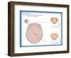 Substantia Nigra & Parkinson's Disease-Monica Schroeder-Framed Giclee Print