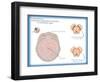 Substantia Nigra & Parkinson's Disease-Monica Schroeder-Framed Giclee Print