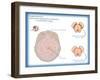 Substantia Nigra & Parkinson's Disease-Monica Schroeder-Framed Giclee Print