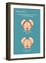 Substantia Nigra & Parkinson's Disease-Monica Schroeder-Framed Giclee Print