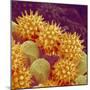 Sunflower pollen at a magnification of x1000-Micro Discovery-Mounted Photographic Print