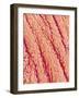 Surface of a valve of a rat heart-Micro Discovery-Framed Photographic Print