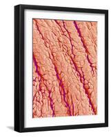 Surface of a valve of a rat heart-Micro Discovery-Framed Photographic Print