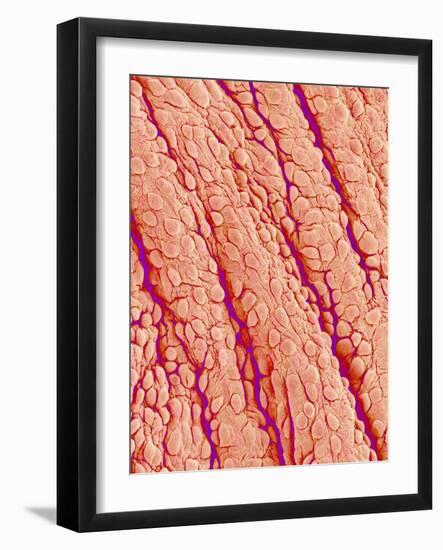 Surface of a valve of a rat heart-Micro Discovery-Framed Photographic Print