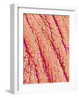 Surface of a valve of a rat heart-Micro Discovery-Framed Photographic Print