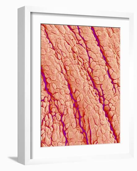 Surface of a valve of a rat heart-Micro Discovery-Framed Photographic Print