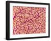 Surface of a valve of a rat heart-Micro Discovery-Framed Photographic Print