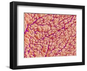 Surface of a valve of a rat heart-Micro Discovery-Framed Photographic Print