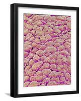 Surface of the pancreas of a rabbit-Micro Discovery-Framed Photographic Print