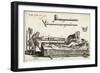 Surgeons Setting a Bone with the Help of Michault's Bone- Setting Apparatus-E.a. Sohn-Framed Art Print