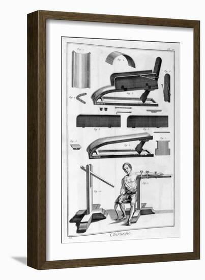 Surgery, 1751-1777-Denis Diderot-Framed Giclee Print