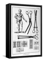 Surgery, 1751-1777-Denis Diderot-Framed Stretched Canvas