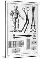 Surgery, 1751-1777-Denis Diderot-Mounted Giclee Print