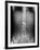 Swallowed Battery, X-ray-Du Cane Medical-Framed Photographic Print