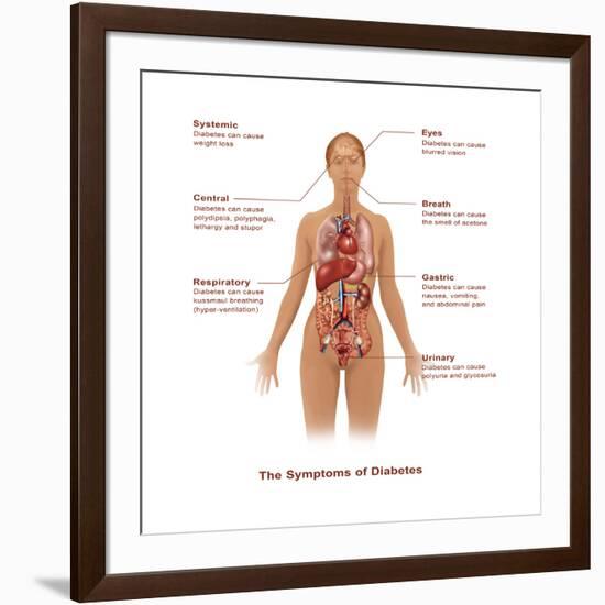 Symptoms of Diabetes-Gwen Shockey-Framed Art Print