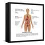 Symptoms of Multiple Sclerosis-Gwen Shockey-Framed Stretched Canvas