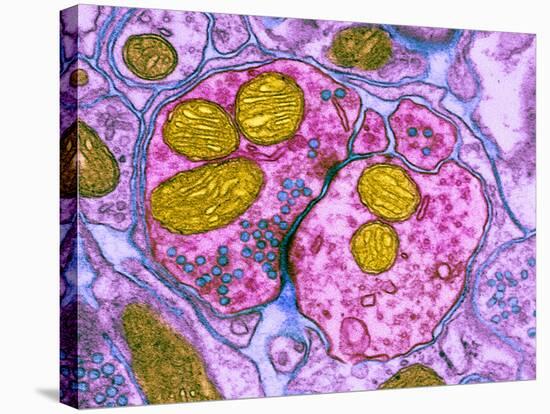 Synapse Nerve Junction, TEM-Thomas Deerinck-Stretched Canvas