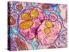 Synapse Nerve Junction, TEM-Thomas Deerinck-Stretched Canvas